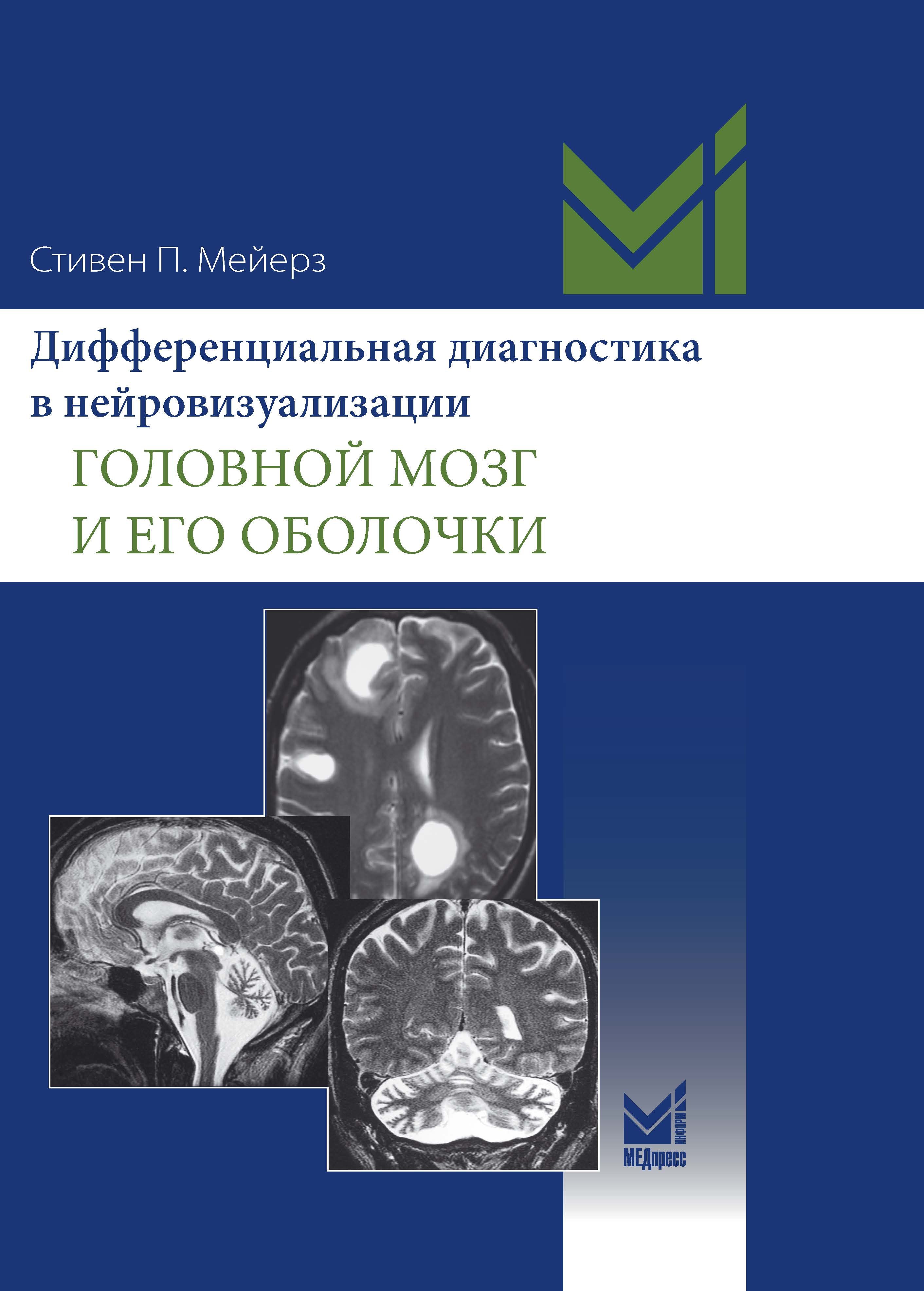 Мейерз Стивен П.: Дифференциальная диагностика в нейровизуализации. Головной мозг и его оболочки