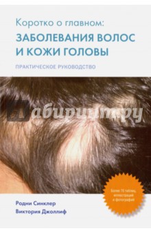 Синклер Родни: Коротко о главном. Заболевание волос и кожи головы