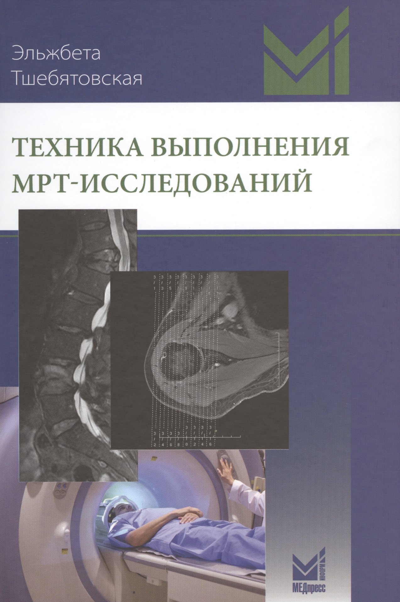 Тшебятовская Эльжбета: Техника выполнения МРТ-исследований
