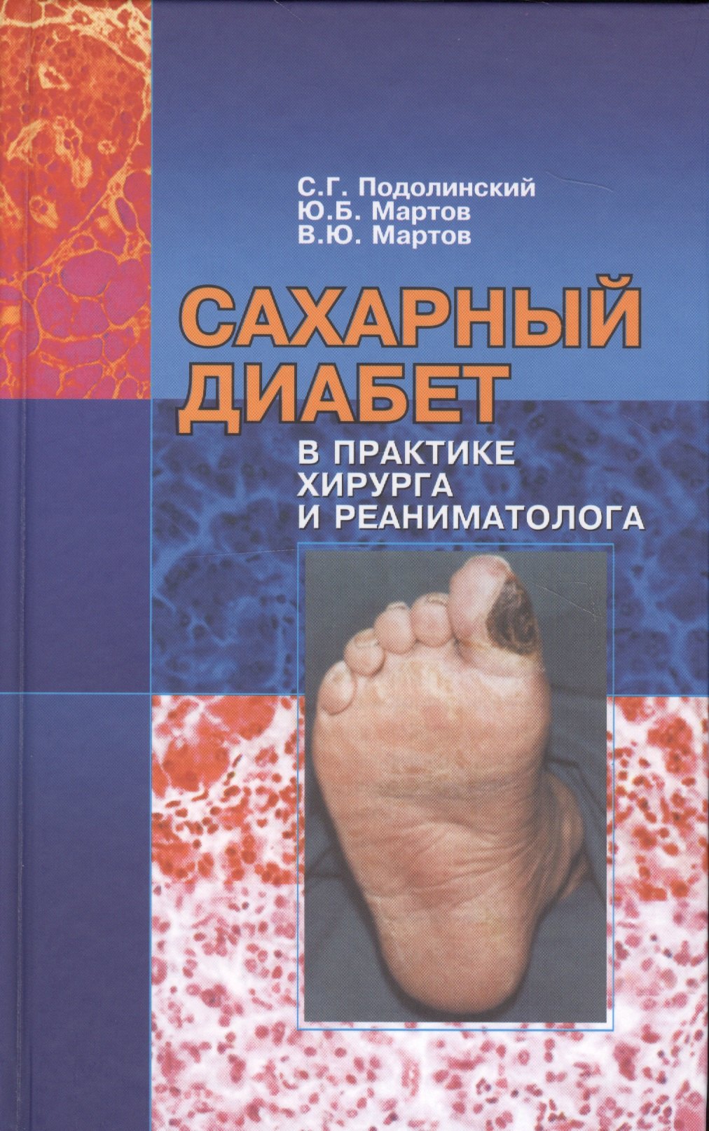 Сахарный диабет в практике хирургая и реаниматолога (монография)