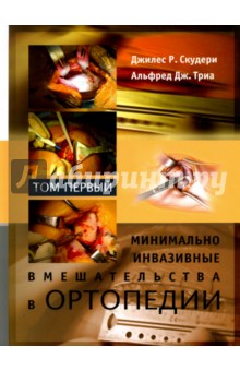 Скудери Джилес Р.: Минимально инвазивные вмешательства в ортопедии. Том 1