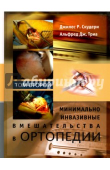 Скудери Джилес Р.: Минимально инвазивные вмешательства в ортопедии. Том 2