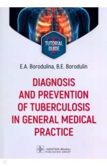 Бородулина Елена Александровна: Diagnosis and prevention of tuberculosis in general medical practice. Tutorial guide